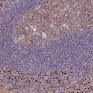 Anti-ERCC6L antibody produced in rabbit 