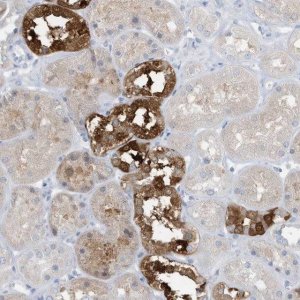 Anti-ERI2 antibody produced in rabbit 