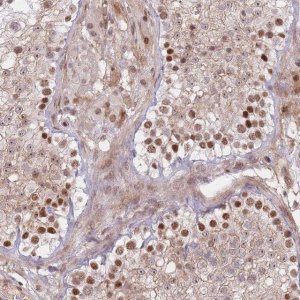 Anti-ERICH6B antibody produced in rabbit 