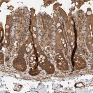 Anti-ERN1 antibody produced in rabbit 