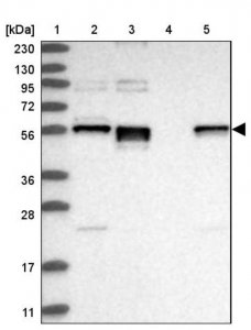 Anti-ERO1B antibody produced in rabbit 