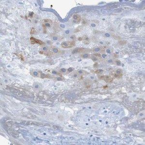 Anti-ERVMER34-1 antibody produced in rabbit 