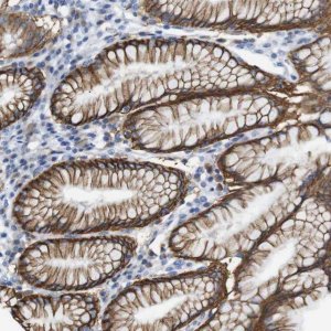 Anti-ERVMER34-1 antibody produced in rabbit 