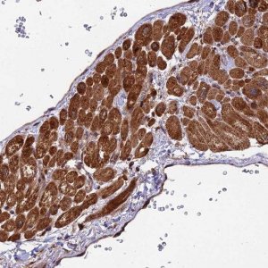Anti-ESCO1 antibody produced in rabbit 