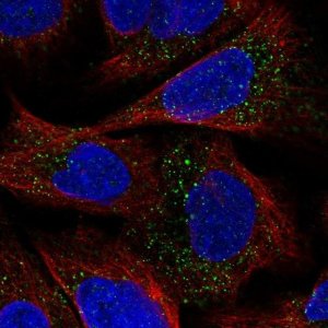 Anti-ESPN antibody produced in rabbit 