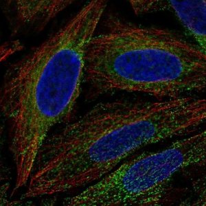 Anti-ESYT1 antibody produced in rabbit 