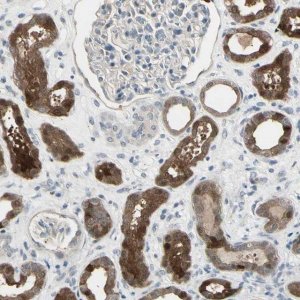 Anti-ETNK1 antibody produced in rabbit 