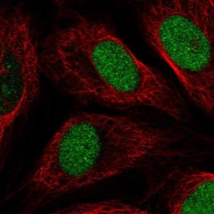 Anti-ETNPPL antibody produced in rabbit 