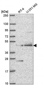 Anti-ETNPPL antibody produced in rabbit 