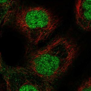 Anti-ETS2 antibody produced in rabbit 