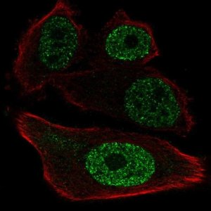 Anti-ETV1 antibody produced in rabbit 