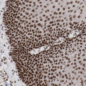 Anti-ETV3 antibody produced in rabbit 