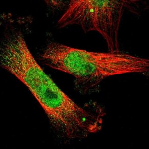 Anti-ETV3 antibody produced in rabbit 