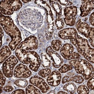 Anti-EVC2 antibody produced in rabbit 