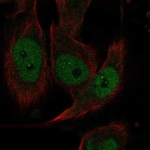Anti-EVI2A antibody produced in rabbit 