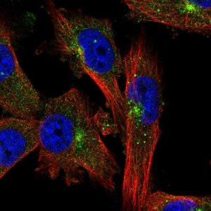 Anti-EVI5 antibody produced in rabbit 
