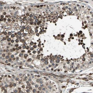 ANTI-EXD2 antibody produced in rabbit 