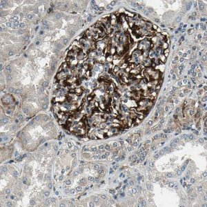 ANTI-EXD2 antibody produced in rabbit 