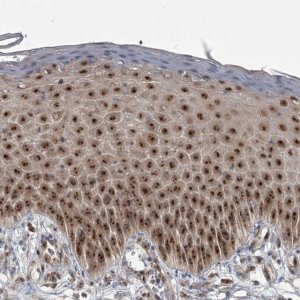 Anti-EXOSC1 antibody produced in rabbit HPA038370-100UL