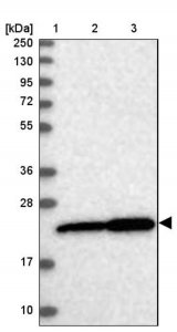 Anti-EXOSC1 antibody produced in rabbit HPA038370-100UL