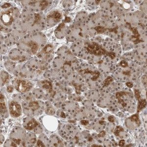 Anti-EXOSC10 antibody produced in rabbit 