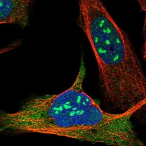 Anti-EXOSC10 antibody produced in rabbit 