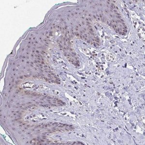 Anti-EXOSC7 antibody produced in rabbit 