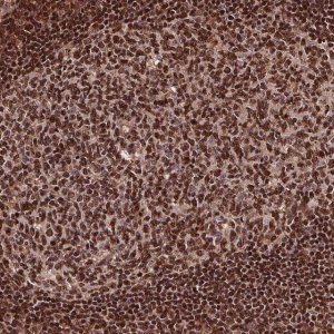 Anti-EXOSC9 antibody produced in rabbit 