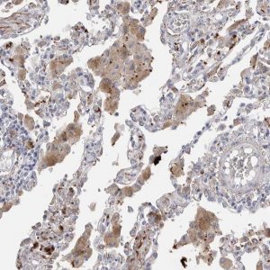 Anti-EYS antibody produced in rabbit 