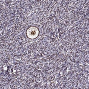 Anti-EZH1 antibody produced in rabbit 