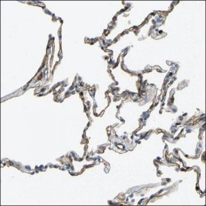 Anti-EZH1 antibody produced in rabbit HPA005478-100UL