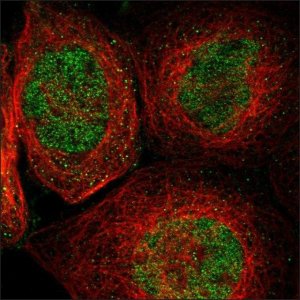 Anti-EZH1 antibody produced in rabbit HPA005478-100UL