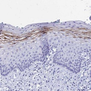 Anti-FA2H antibody produced in rabbit 