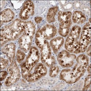 Anti-FAAH2 antibody produced in rabbit HPA027534-100UL