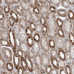 Anti-FAAP100 antibody produced in rabbit 