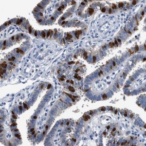 Anti-FADS6 antibody produced in rabbit 