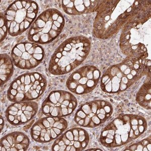 Anti-FAIM antibody produced in rabbit HPA052209-100UL