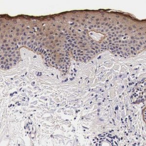 Anti-FAM109B antibody produced in rabbit 