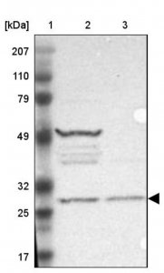 Anti-FAM109B antibody produced in rabbit 