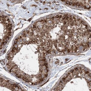 Anti-FAM114A2 antibody produced in rabbit HPA035869-100UL