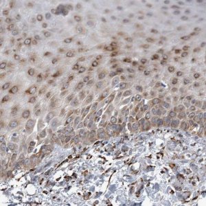 Anti-FAM160B2 antibody produced in rabbit 