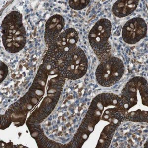 Anti-FAM174B antibody produced in rabbit 