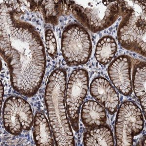 Anti-FAM222A antibody produced in rabbit 