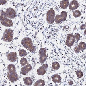 Anti-FAM25A antibody produced in rabbit 