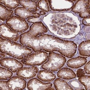 Anti-FAM46A antibody produced in rabbit 