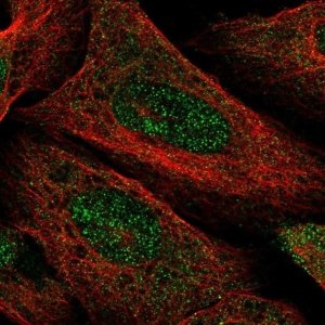 Anti-FAM46C antibody produced in rabbit 