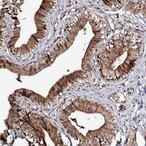 Anti-FAM53B antibody produced in rabbit 