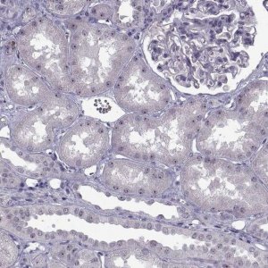 Anti-FAM60A antibody produced in rabbit 