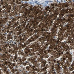 Anti-FAM65A antibody produced in rabbit 