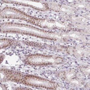 Anti-FAM65C antibody produced in rabbit 